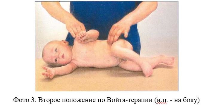 войта 3.JPG