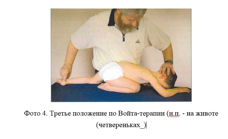 войта 4.JPG