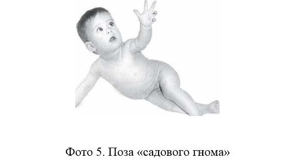 войта 5.JPG