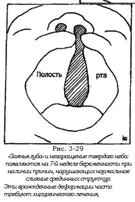 зайчья губа.JPG